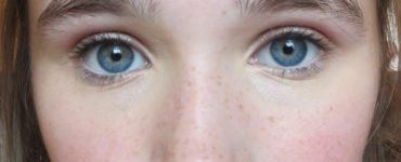Do purple eyes exist?
