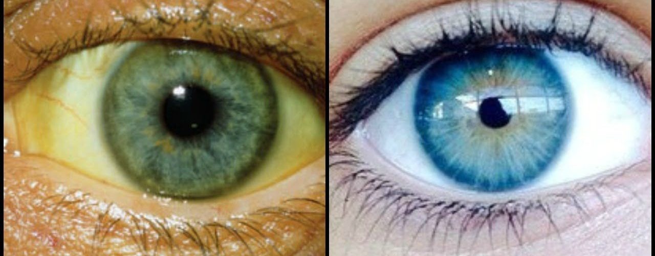How can I get the whites of my eyes to color?