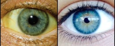 How can I get the whites of my eyes to color?