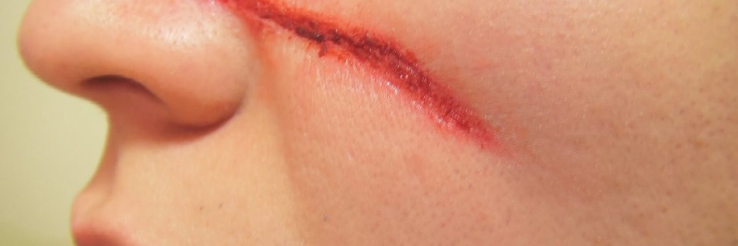 How do you make fake scars heal?