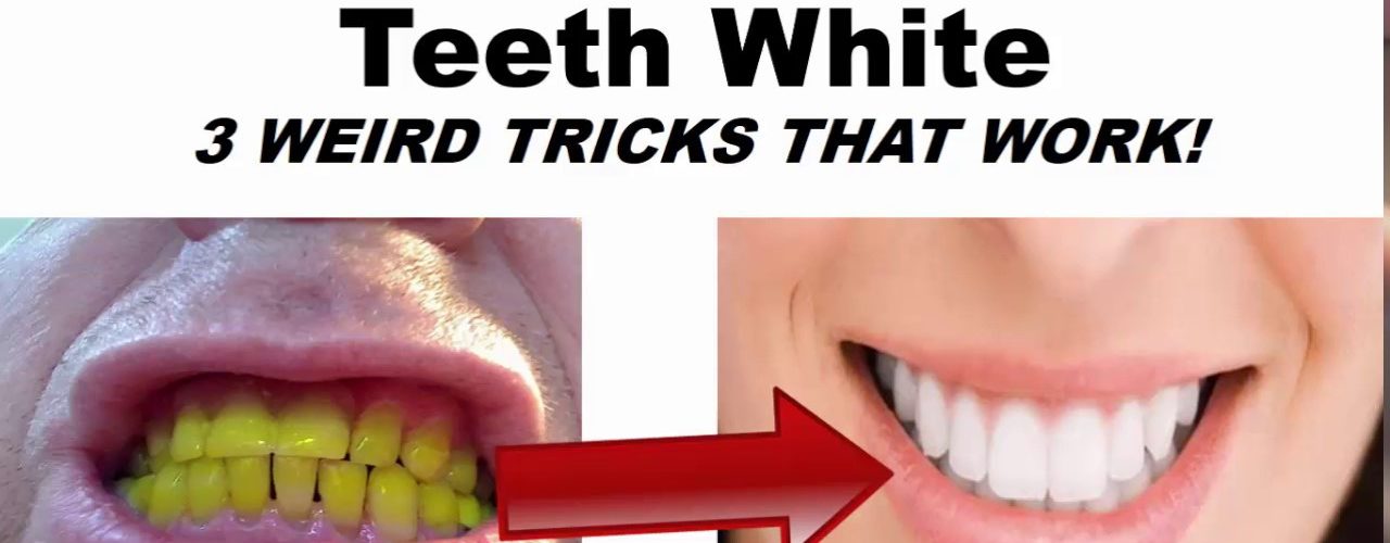 How do you make fake teeth whiter?
