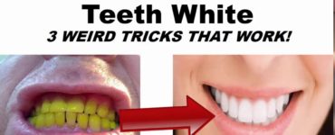 How do you make fake teeth whiter?