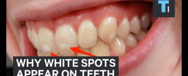 What can I paint on my teeth to make them white?