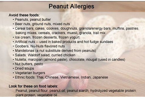 What foods to avoid if you have a peanut allergy?